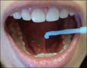 gümüş suyu dil altında